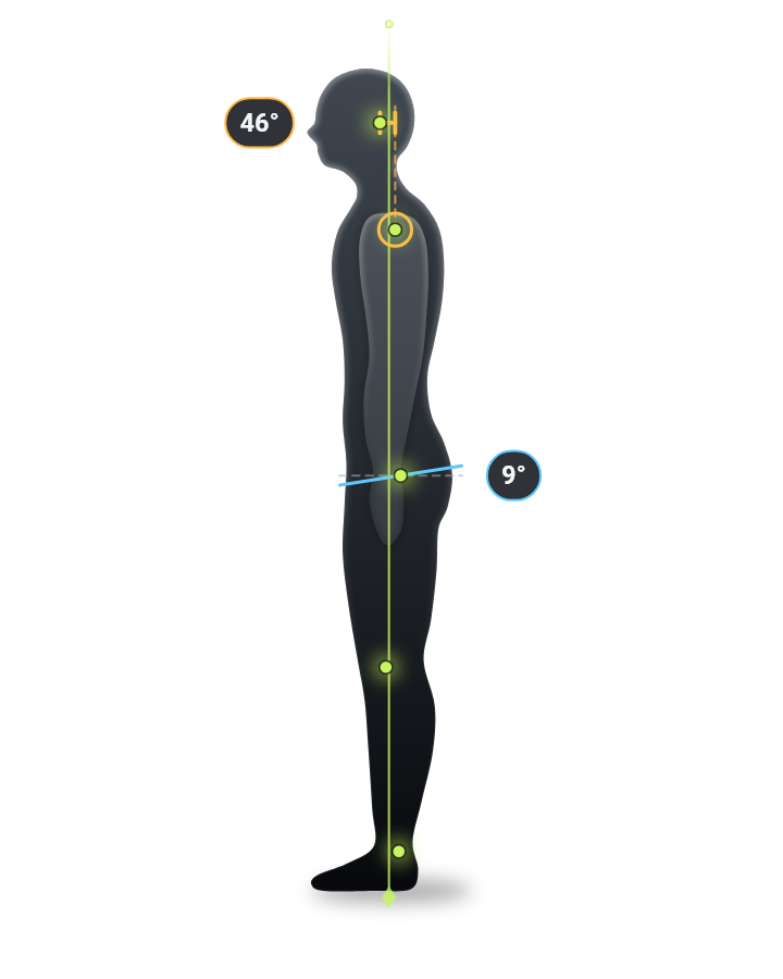 Sample side-view body scan. A plumb line runs from ankle to ear. The head sits forward of it, with a neck angle of 46 degrees, and the hips tip forward 9 degrees.